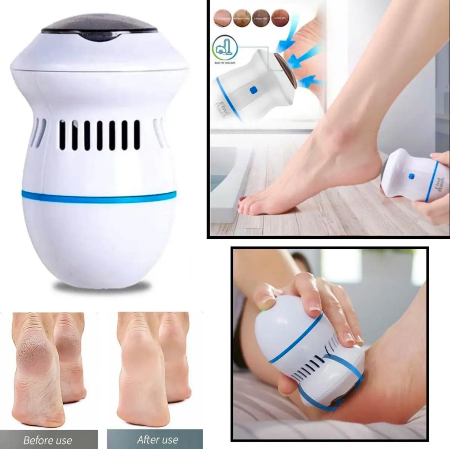 Foot Pedicure Grinder Dead Skin Remover Machine USB Electric Automatic Polisher Callus Cleaning